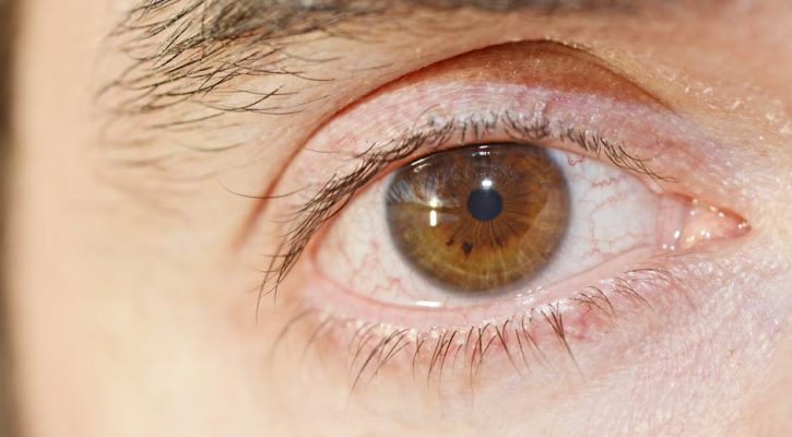 探究去眼紋療程的文化意義與歷史發展